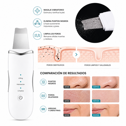 Glow Expert 3 en 1 | Espátula Ultrasónica Facial