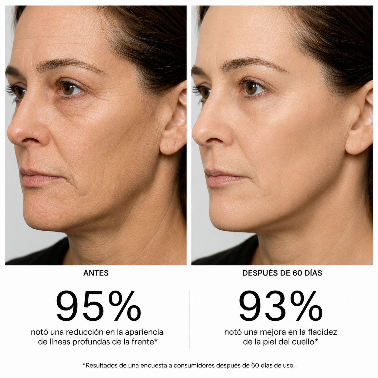 Masajeador Facial EMS Reafirmante Antiage para Papada, Rostro y Cuello